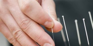 Acupuncture Milton Keynes